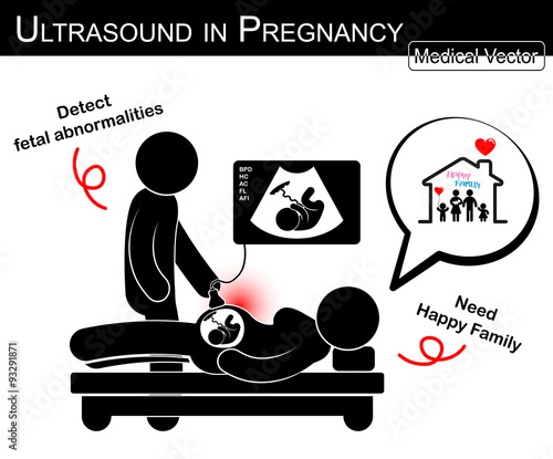 Doctor check up pregnant woman and fetal growth in uterus by ultrasonography ( woman think about happy family in future )( Medical , Science and Healthcare concept )( black and white , flat design )