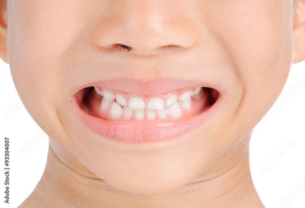 Obraz premium Smile teeth from kid