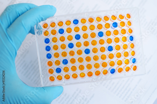 Enzyme-linked immunosorbent assay (ELISA), Immunology testing method in laboratory