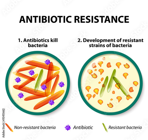 Antibiotic resistance