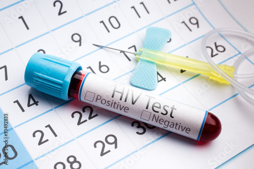 Blood test for analysis of HIV /blood sample in a tube with label HIV on a monthly planner appointments