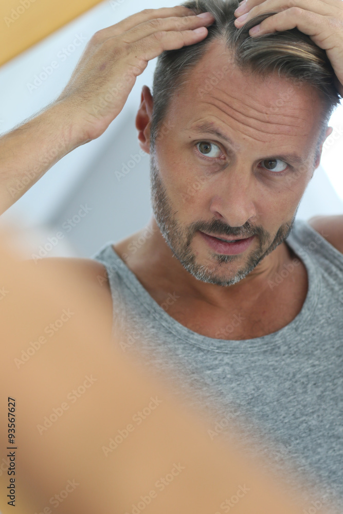 Obraz premium Middle-aged man concerned by hair loss