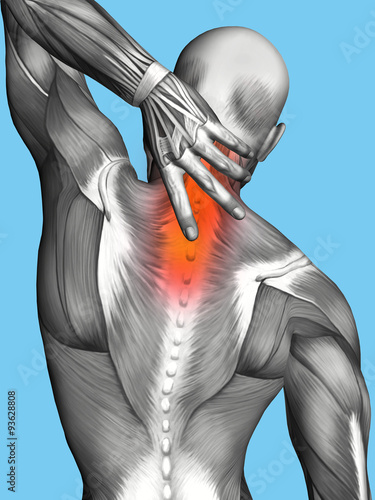 Anatomy of Male With Upper Back Pain: Featuring male figure reaching for upper back showcasing muscular groups such as trapezius, infraspinatus, teres major, latissimus dorsi and deltoid muscles