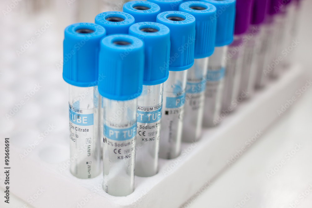 test tubes for testing test tubes for testing