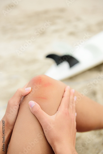 Photography Sport injury - painful knee surfing accident