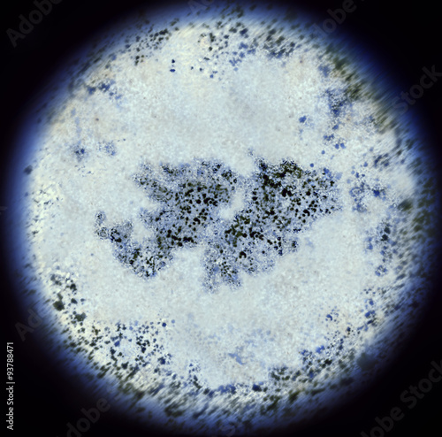 Bacterias in the shape of Falkland Islands viewed through a micr photo