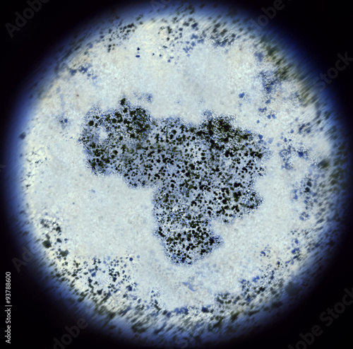 Bacterias in the shape of Venezuela viewed through a microscope. photo