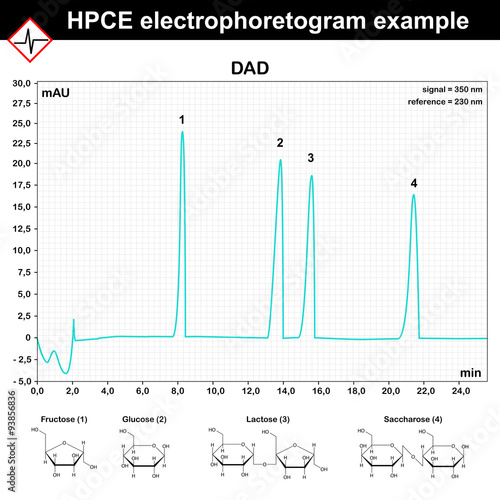 HPCE electrophoretogram example