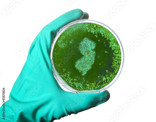 Germs in the shape of New Jersey in a petri dish.(series)