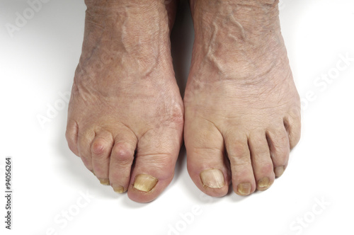 senior woman foot