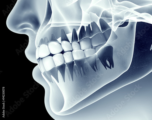 x-ray image of a jaw with teeth photo