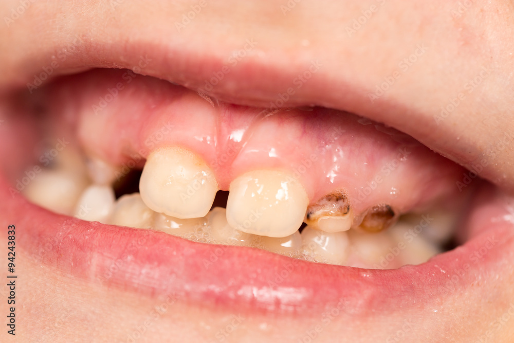 Naklejka premium baby teeth in the mouth