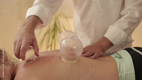 Woman treated with cupping photo