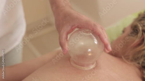 Warming up cups for cupping therapy photo