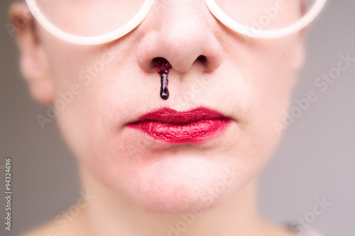 closeup of woman with nosebleed photo