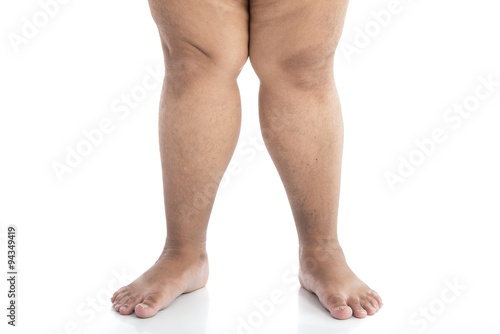 Close up of legs with overweight standing