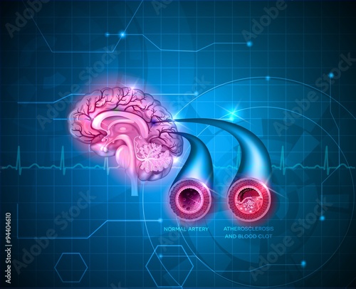 Human brain healt care