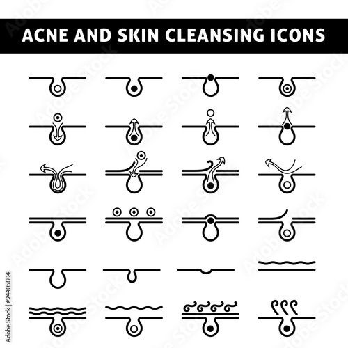 acne skin care