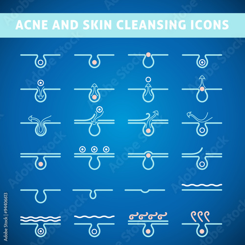 acne skin care