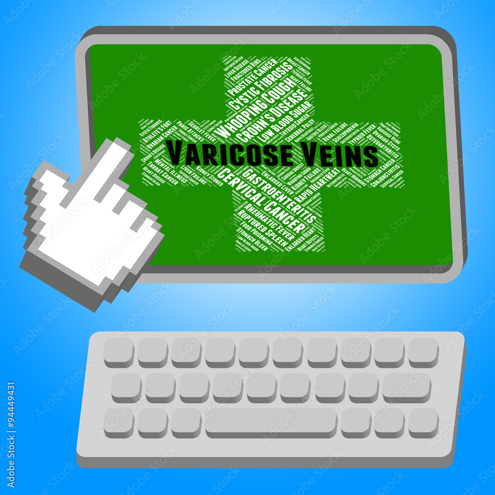 Varicose Veins Represents Blood Vessels And Afflictions Varicose Veins Represents Blood Vessels And Afflictions