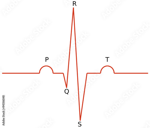 1065 - ECG waves