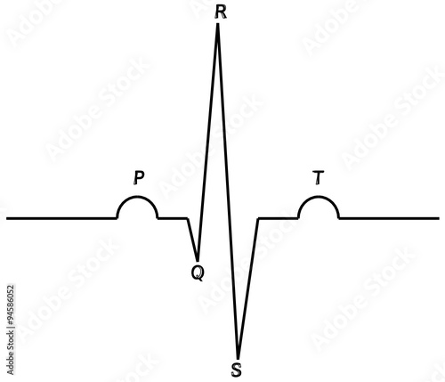 1067 - ECG waves