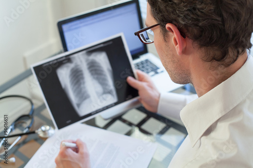 doctor looking at x-ray of lungs and writing diagnosis photo