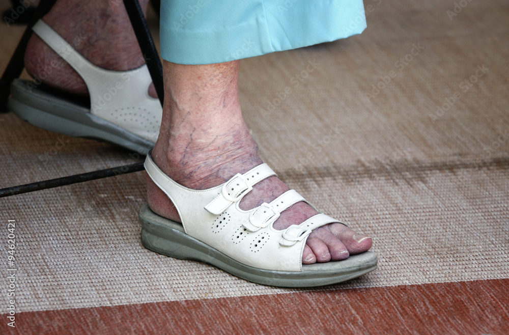 Fit of elderly woman with varicose veins Fit of elderly woman with varicose veins