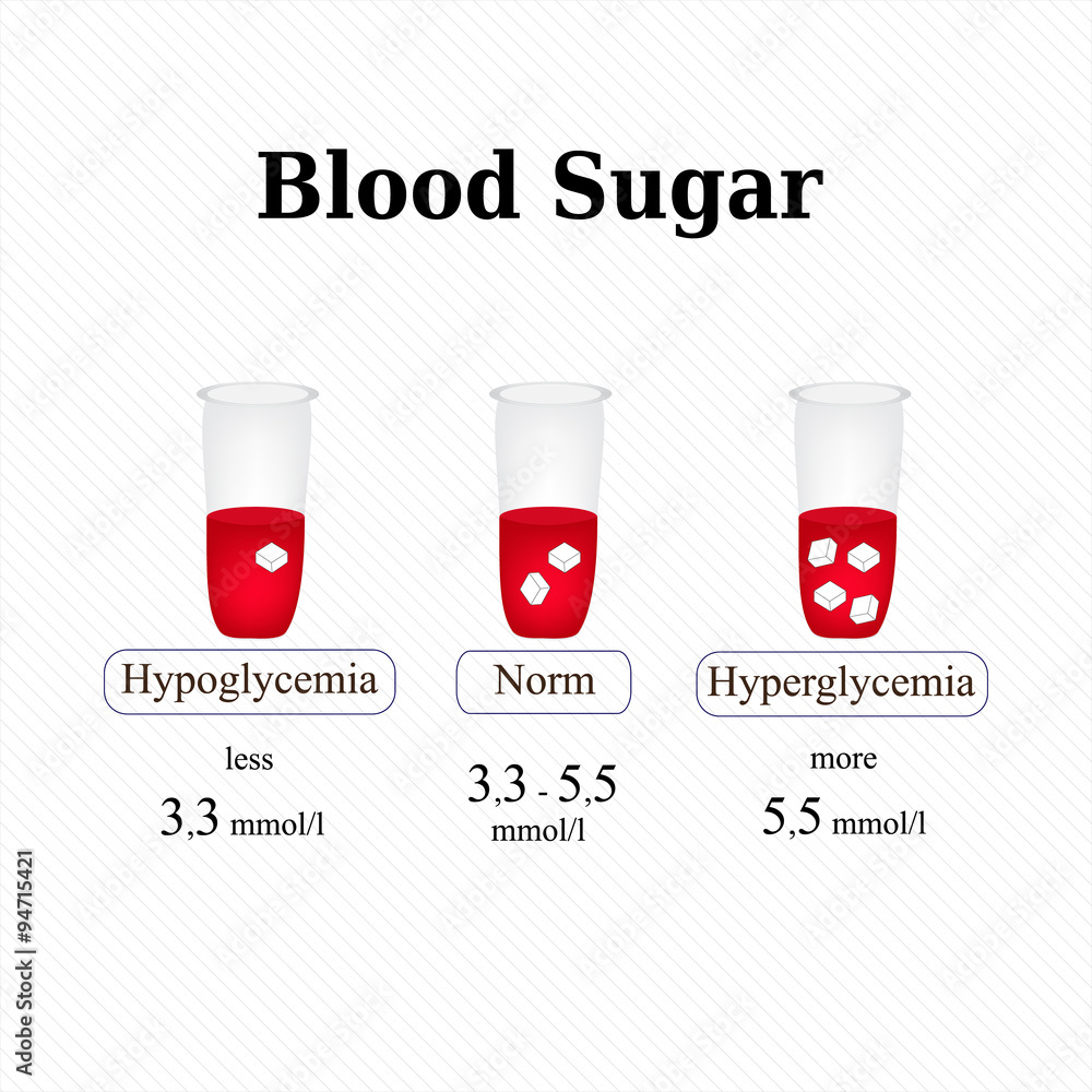The level of sugar in the blood. Hypoglycemia. Hyperglycemia. Infographics. Vector illustration The level of sugar in the blood. Hypoglycemia. Hyperglycemia. Infographics. Vector illustration