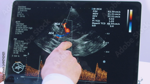 male hand analyzing a sonogram on computer photo
