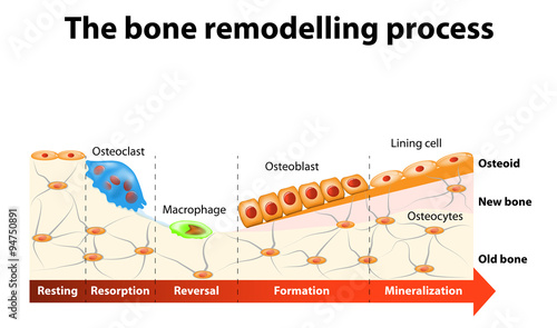 bone remodelling process photo