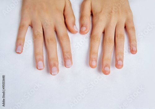 woman hands with nails before treatment