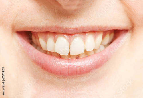 Lächelnder Mund mit weißen Zähnen