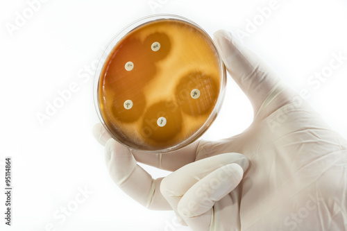 Fényképezés Hand with gloves holding petri dish with bacterial colonies