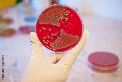 Laboratory doctor holding petri dish with Escherichia Colli. Medical laboratory concept photo