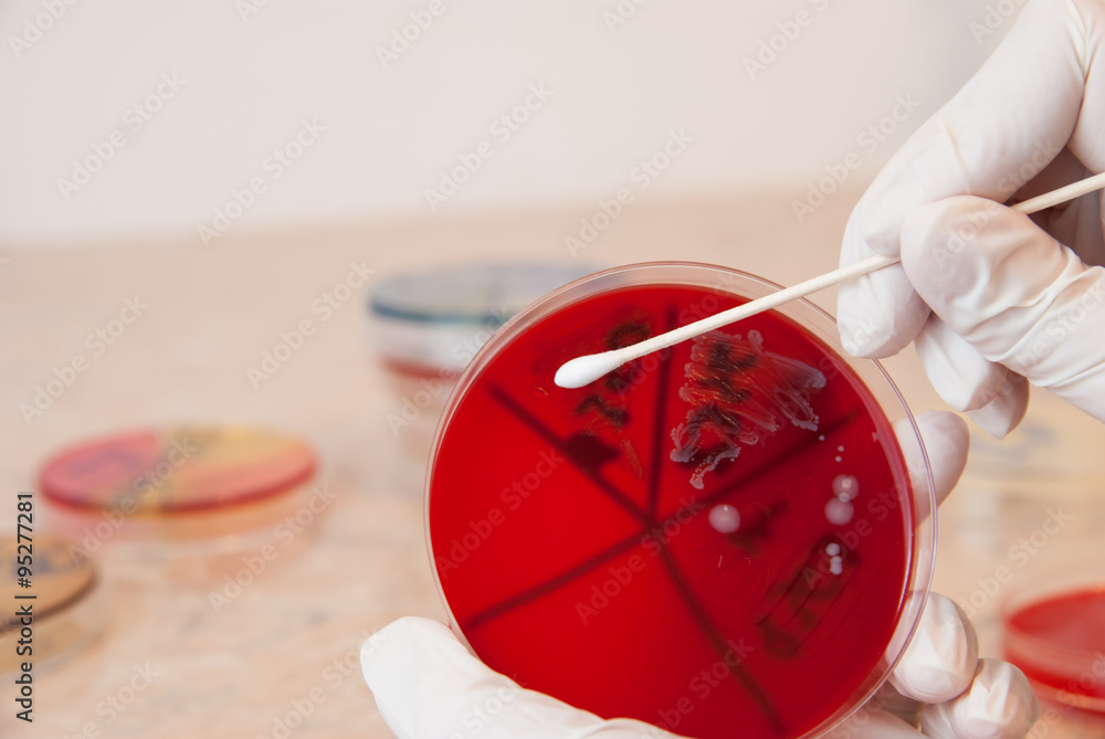 Scientist with sterile swab retrieving Streptococcus bacteria from