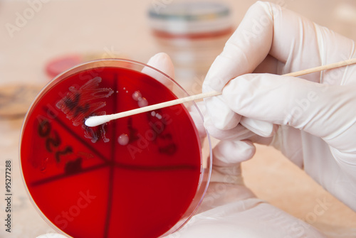 Laboratory doctor retrieving a sample of Enterococcus faecalis bacteria with sterile swab photo