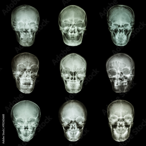 Collection of asian's skull