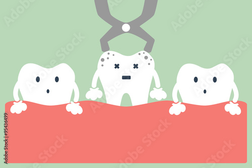 tooth extraction