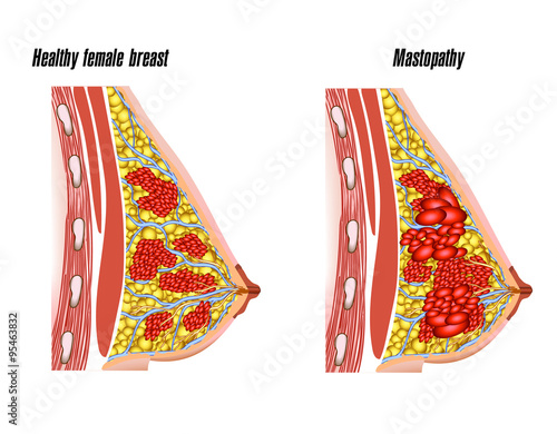 anatomy of the female breast