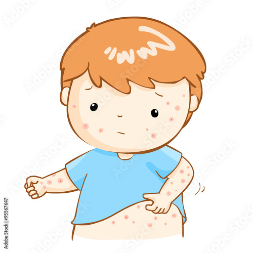 boy scratching itching rash on his body vector