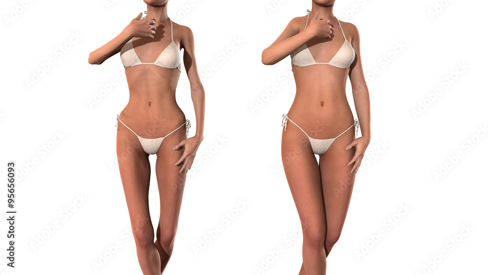 woman's body normal and underweight Stock Illustration | Adobe Stock