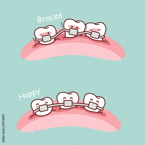 cute cartoon tooth braces