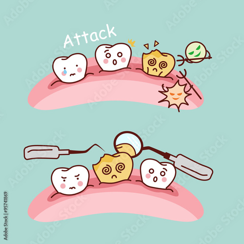 cute cartoon tooth cavity
