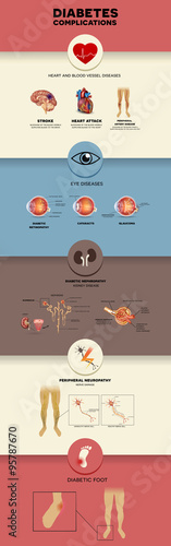 Diabetes mellitus