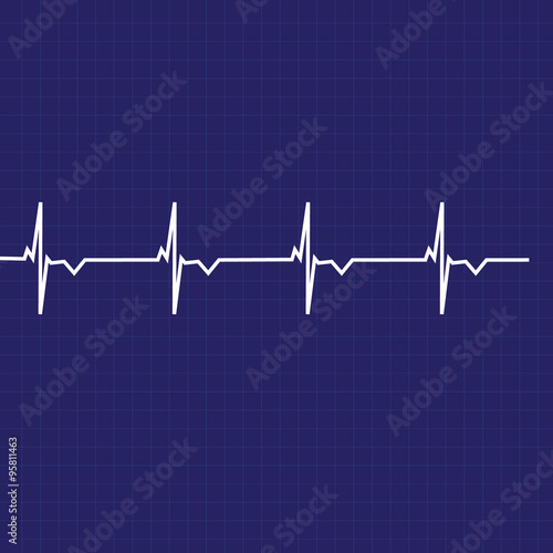 Ekg line