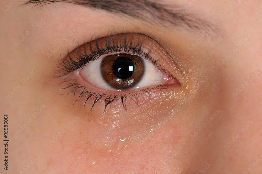 Crying eye Crying eye