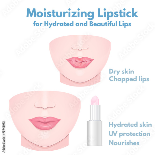 dry cracked lips