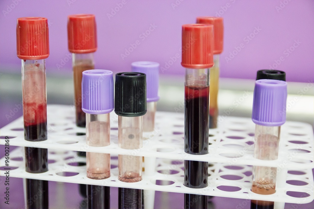 Machine Blood Bank with Tubes Machine Blood Bank with Tubes