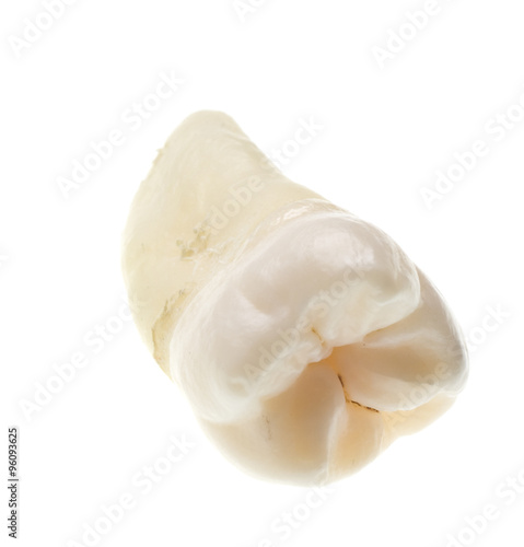 extracted wisdom tooth isoalted on white